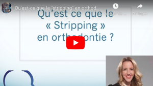 Qu'est ce que le  stripping  en orthodontie?